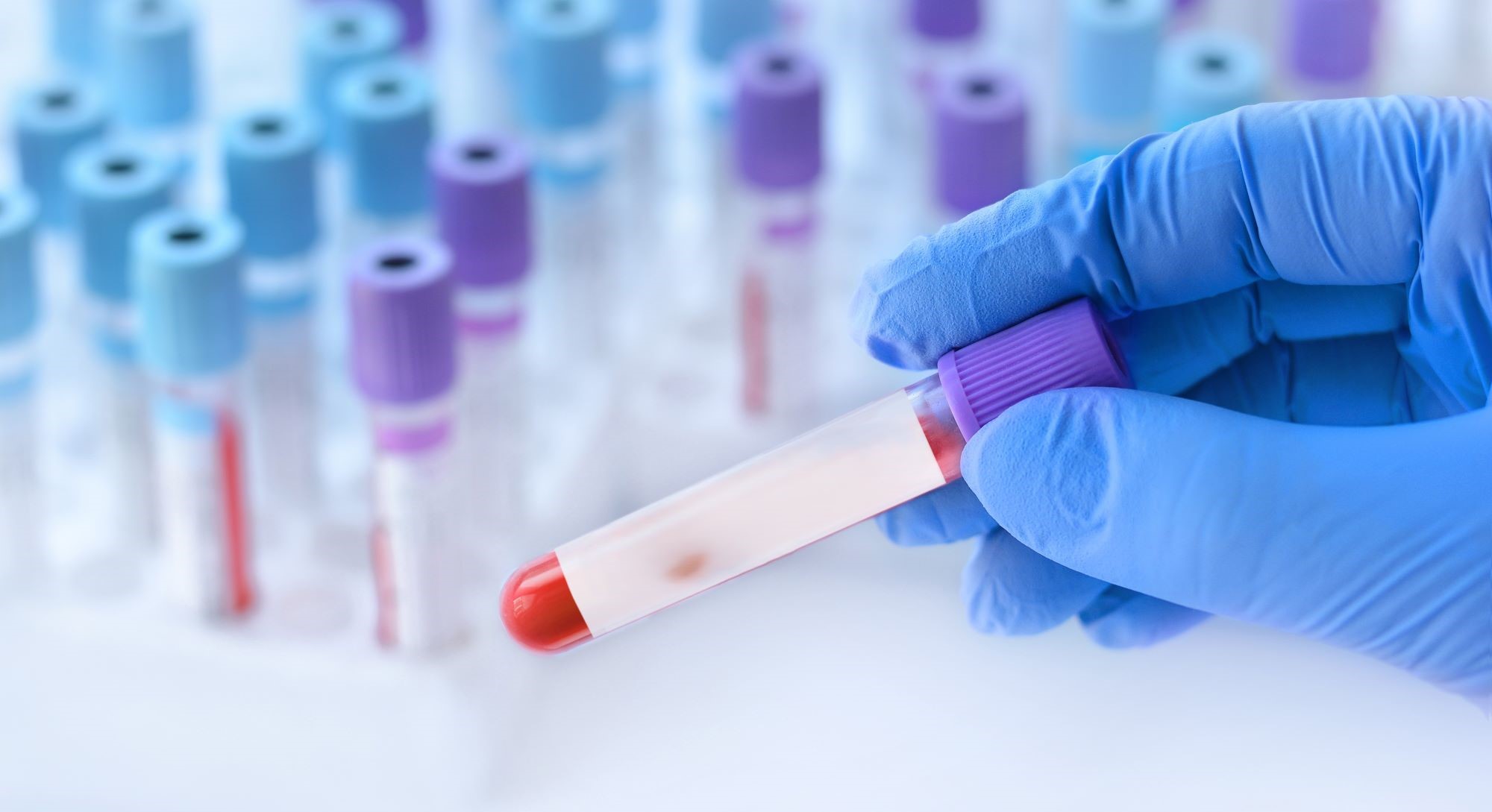 雙靶向CAR-T免疫細胞治療發展現況